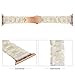 Produktbild TianranRT Watch Band Acetat Fiber+Metal Ersatz Armband für Apple Watch Serie 4 44 mm (Mehrfarbig)