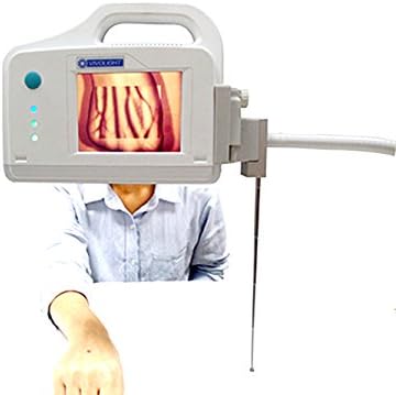 Infrared Projection Vein Finder, Bedside Screen Display Vein Viewer Locator Detector for Clinic, Transfusion, Aesthetic Center, Pediatrics,Nurses Doctor Use