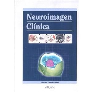 Neuroimagen Clinica