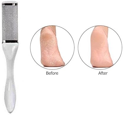 Foot Exfoliator and Hard Skin Remover - Foot File to Remove Dead Skin &amp; Coarse Callus