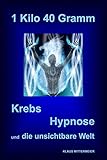 Image de 1 Kilo 40 Gramm: Krebs - Hypnose & die unsichtbare Welt
