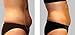 2 Body Wrap Applicator