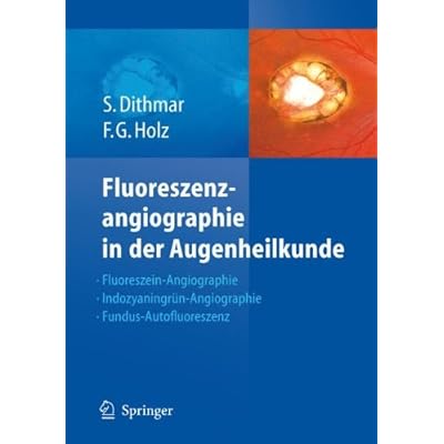 [PDF] Fluoreszenzangiographie in der Augenheilkunde: Fluoreszein-Angiographie - Indozyaningrün-Angiographie und Fundus-Autofluoreszenz: ... Und Fundus-autofluoreszenz KOSTENLOS DOWNLOAD