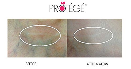 Narbengel – FLAWless – Natürliche Schadenbehebungskur + Für Narben und Wulstnarben (Keloide) + Aknenarben + Operationsnarben + Reduziert Rötungen & Kupferrosen (Rosazea) & Besenreiser + konzentrierte Formel (30ml) - 6