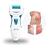 Valentines Gifts for her -Best Selling Pedicure Hard Skin Remover in U.S. -A Portable Foot File Removes Callus and Dead, Hard & Coarse Skin on Feet - Foot Spa-Like Results at Home