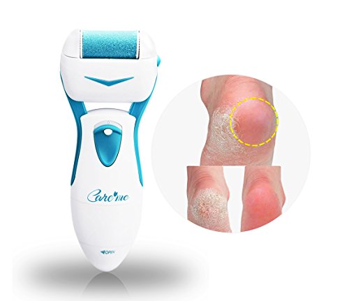 Valentines Gifts for her -Best Selling Pedicure Hard Skin Remover in U.S. -A Portable Foot File Removes Callus and Dead, Hard & Coarse Skin on Feet - Foot Spa-Like Results at Home