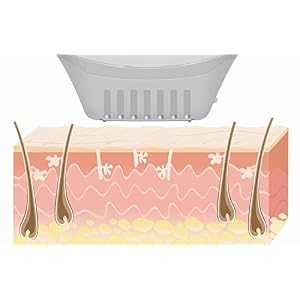 Beurer Salon Pro Permanent Hair Removal System with Life Time Flash - Image 15