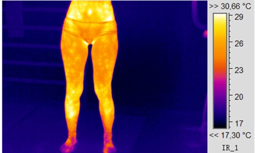 Delfin Spa Fitness Capri-Hose mit Wärme-Effekt (Schwitzhose) – aus Neopren mit Biokeramik Fasern - 5