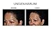 HOLLYWOOD BROWZER (includes 2 Browzers and a Protective Pouch) For Eyebrow Shaping, Removing Unwanted Hair and Dermaplaning/Exfoliation