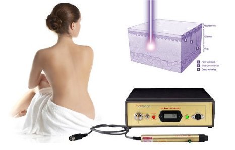 Avance DM9000 High Power Professional Hair Removal Laser Pen