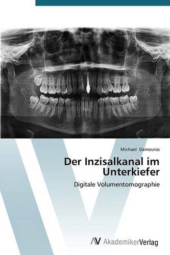 Der Inzisalkanal im Unterkiefer: Digitale Volumentomographie