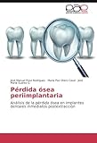 Image de Pérdida ósea periimplantaria: Análisis de la pérdida ósea en implantes dentales inmediatos postextracción