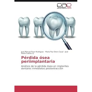 Pérdida ósea periimplantaria: Análisis de la pérdida ósea en implantes dentales inmediatos postextracción