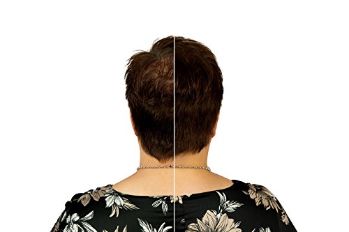 Plus additional hair Haarauffüller für Männer & Frauen – mit Soforteffekt – 25 g – gegen Teilglatze – verschiedene Farben – Haarverdichtung (schwarz) - 7