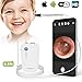 Price comparison product image Wireless Otoscope, Anykit WiFi Ear Scope Inspection Camera 3.9mm Diameter Earwax Removal Tool with 6 LED Lights, Suitable for iOS and Android Smartphone, iPhone, iPad, Tablet, Samsung