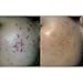 The Dermaflannel by Bravura London | Deep Exfoliating Cloth, Natural Way to Achieve the Effects of a Chemical Peel