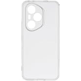 Zore Honor ile uyumlu 400 Pro 2mm Anti Shock Silikon Şeffaf