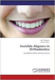 clear plastic aligners cost