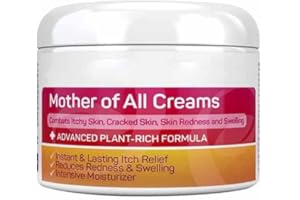 Allbestaye Skin Psoriasis Cream Dermatitis And Eczema Eczema Ointment Treat Dry, Itchy And Sensitive Skin, Face And Body Care Skin Redness And Rash (50g)