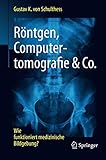 Image de Röntgen, Computertomografie & Co.: Wie funktioniert medizinische Bildgebung?