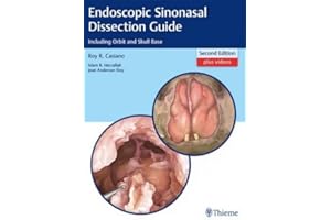 ENDOSCOPIC SINONASAL DISSECTION GUIDE 2ND ED INDIAN REPRINT [Paperback] THIEME