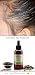 Justnatural Natural Grow New Hair Treatment