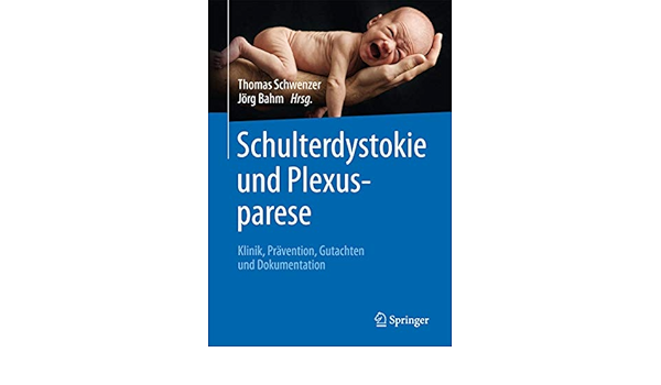 Schulterdystokie Und Plexusparese Klinik Pravention Gutachten Und Dokumentation Amazon De Schwenzer Thomas Bahm Jorg Bucher