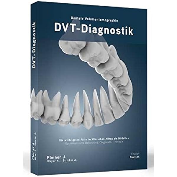 Dvt Diagnostik Dentale Volumentomographie Die Wichtigsten Falle Im Klinischen Alltag Als Bildatlas Systematisierte Befundung Diagnostik Therapie Amazon De Fleiner Jonathan Weyer Nils Stricker Andres Bucher