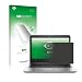 Produktbild upscreen HP EliteBook 840 G3 Blickschutzfolie Privacy Screen Sichtschutzfolie, Anti-Spy Displayschutzfolie