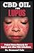 Produktbild CBD OIL FOR LUPUS: Potent Home Remedy for Lupus and other Skin Infections