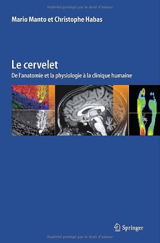 Le cervelet: De l'anatomie et la physiologie ???? la clinique humaine (French Edition) by Mario Manto (2013-10-16) francais Le cervelet: De l'anatomie et la physiologie ???? la clinique humaine (French Edition) by Mario Manto (2013-10-16) francais