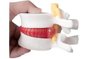 BoNew 1:1.5 Anatomical Human Lumbar Vertebrae Degenerative Lumbar Human Spine Model White Color