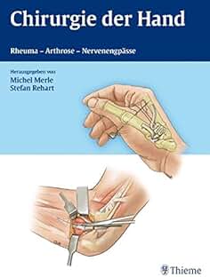 Suchergebnis Auf Amazonde Für Handchirurgie Gebraucht - 