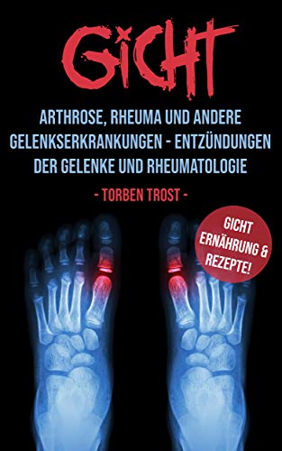 Gicht Arthrose, Rheuma, und andere Gelenkserkrankungen - Entzündungen der Gelenke und Rheumatologie Gicht Arthrose, Rheuma, und andere Gelenkserkrankungen - Entzündungen der Gelenke und Rheumatologie