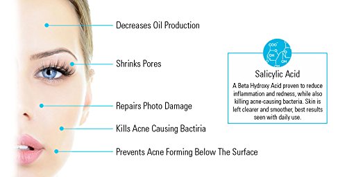 Salicylsäure bha Chemisches Peeling Gegen Aknenarben Anti-Pickel – 2% Salicylsäurepeeling Sanftes Peeling – Natürlich Gewonnen Aus Weidenrinde 30ml - 6