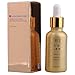 Fungal Nail Treatment Nail Polish Essence Oil Hand And Foot Whitening Toe Nail Fungus Removal