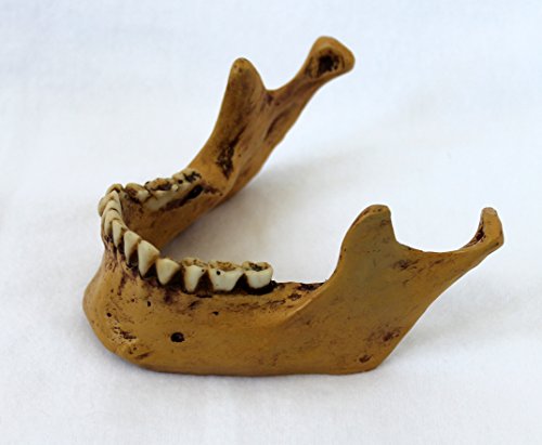 Anatomie Schädel mit Unterkiefer von Markus Mayer - 6