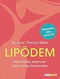 Image de Lipödem: Rechtzeitig erkennen und richtig behandeln. Wirksame Hilfe ohne OP