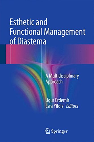 Preisvergleich Produktbild Esthetic and Functional Management of Diastema: A Multidisciplinary Approach