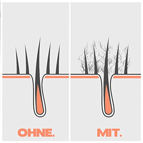 -26g- IMPERIO STREUHAAR zur HAARVERDICHTUNG & VOLLEM HAAR in Sekunden. SCHÜTTHAAR-100% Natur! (DUNKELBRAUN) - 7