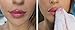 SUGAR LIP SCRUB EXFOLIATOR TREATMENT *NATURAL INGREDIENTS* TREATMENT DRY LIPS (RASPBERRY)