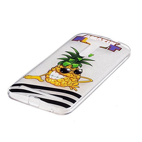 ASUS ZenFone 2 Laser (ZE500KL) Hülle,MAGQI Transparent Ultra Dünn Gel TPU Bumper Tasche mit Bunter Cartoon Design [Kratzfeste,Scratch-Resistant] [Crystal Clear] Weiche Silikon Gummi Schutzhülle [Frei Stylus Pen] 360 edge protection für ASUS ZenFone 2 Laser (ZE500KL) – Ananas - 2
