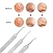 FEITONG 3pcs Curved Blackhead Comedone Clip Needle Tweezers Pimple Extractor Remover (Silver)