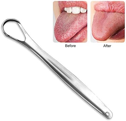 MOGOI Tongue Scrapper, Tongue Cleaner Stainless Steel Oral Tongue Sweepers Health Cleaning Tool, Fresh Breath