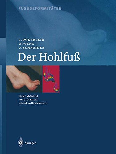 Preisvergleich Produktbild Fussdeformitäten: Der Hohlfuss