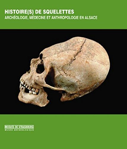Histoire(s) de squelettes : Archéologie, médecine et anthropologie en Alsace by Bernadette Schnitzler, Jean-Marie Le Minor, Bertrand Ludes, Eric Boës