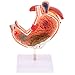 Produktbild Fenteer Pathologischen Magenstruktur Anatomie Modell als Display und Sammeln, aus Kunststoff
