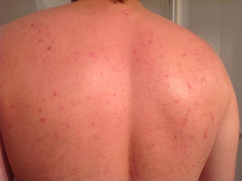 JB repair+care Nachtkerze “ Silber aktiv „… mit dem Silber- / Sauerstoff Komplex, bei Pickeln und Akne, sowie verstopfte Poren - 5