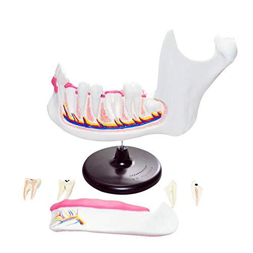 BIUYYY Dentadura Dental Y Modelo Anatómico Molar, Modelo De Dientes De Estudio De Enseñanza