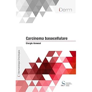 Carcinoma basocellulare